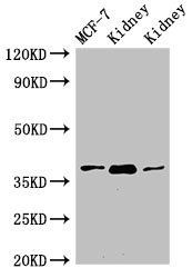 HAO2 antibody