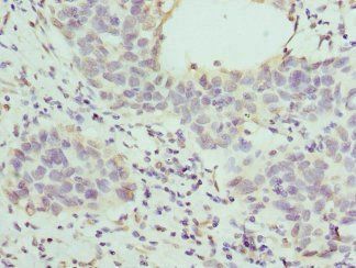 HAPLN1 Antibody