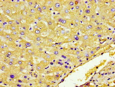 HP Antibody