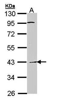 Haptoglobin antibody