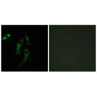 HARS Antibody