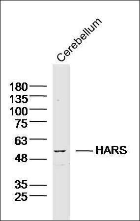 HARS antibody