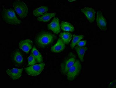 HAS1 Antibody