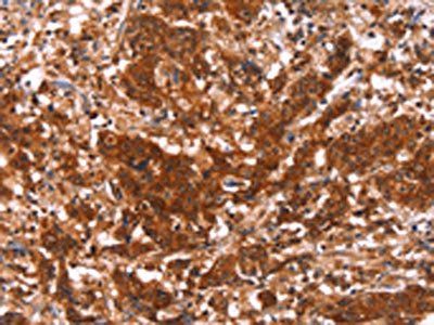 HAS1 Antibody
