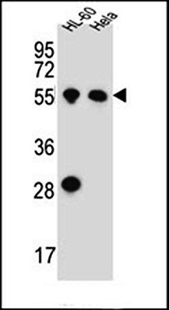 HAS2 antibody