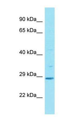 HAUS2 antibody