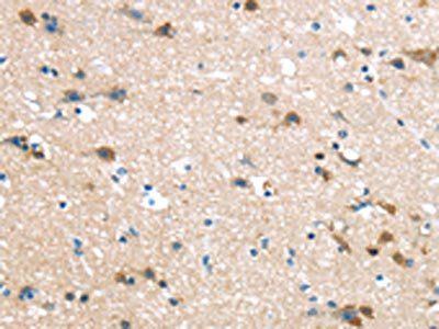 HAUS7 Antibody