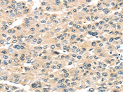 HAUS7 Antibody