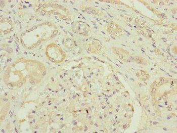HAUS8 Antibody