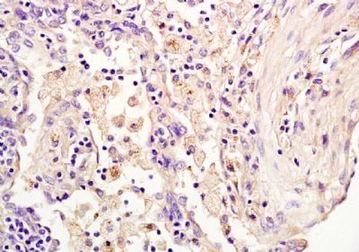 HAUSP Rabbit Polyclonal Antibody
