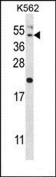HAVCR1 antibody