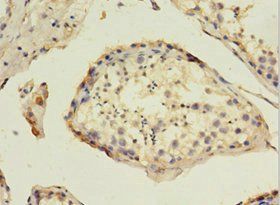 HAVCR1 Antibody