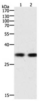 HAVCR1 Antibody