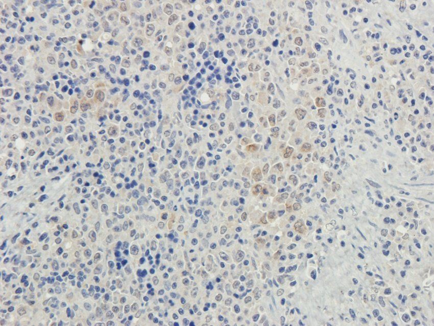 HAVCR2 antibody