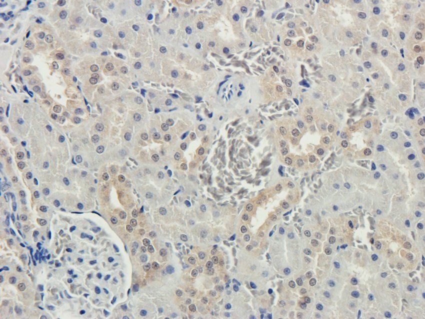 HAVCR2 Rabbit Polyclonal Antibody