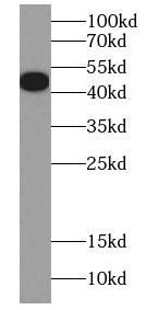 HB9 antibody