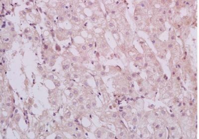 HBXIP Rabbit Polyclonal Antibody