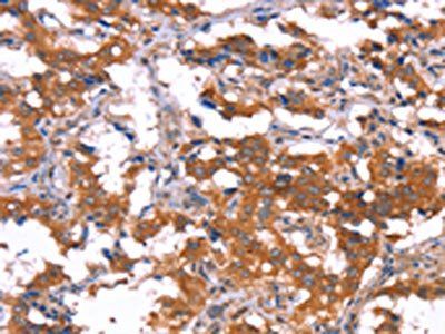 HCAR2 Antibody