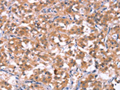 HCAR2 antibody