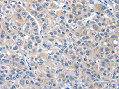 CGB Antibody