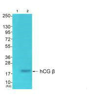 HCG antibody