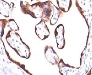 HCG-beta Antibody