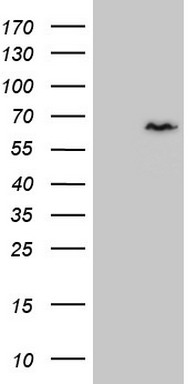 hCG beta Antibody