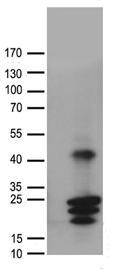 hCG beta (CGB7) antibody