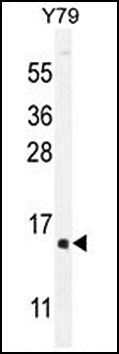 hCG_1995004 antibody