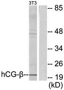 hCG β Antibody