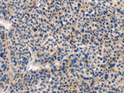 HCK Antibody
