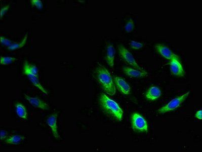 HCLS1-associated protein X-1 antibody