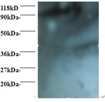 HCLS1-associated protein X-1 antibody (Biotin)