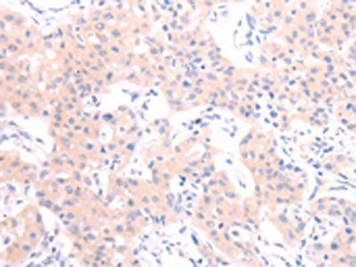 HCRT Antibody