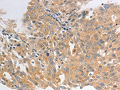 HCRTR2 antibody