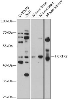 HCRTR2 antibody