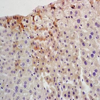HCV NS3 Rabbit Polyclonal Antibody