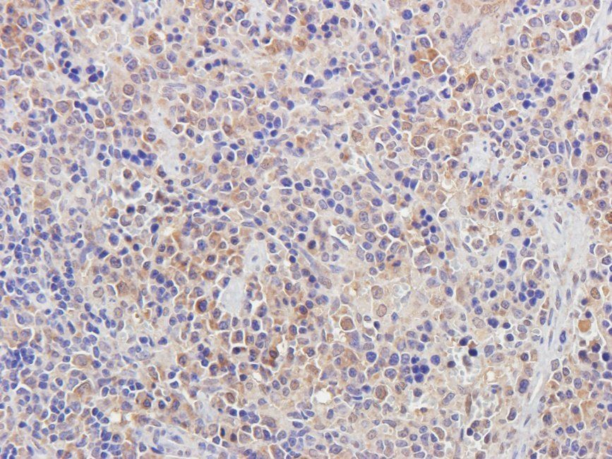 HDAC2 antibody