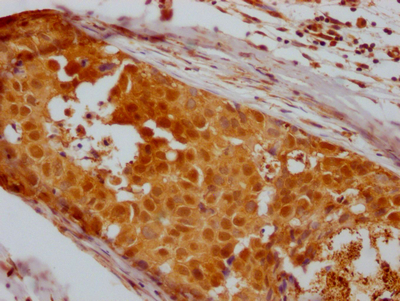 HDAC2 Recombinant Monoclonal Antibody