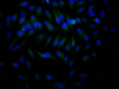 HDAC2 Recombinant Monoclonal Antibody