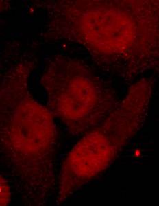 HDAC2 (Phospho-Ser394) Antibody