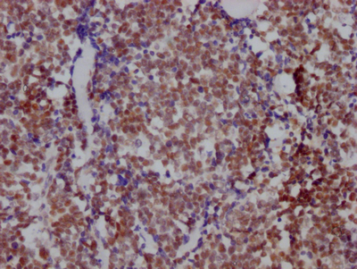 HDAC3 Recombinant Monoclonal Antibody