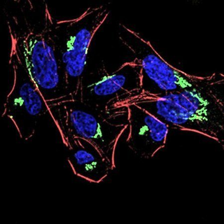 HDAC4 Antibody