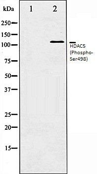 HDAC5 (Phospho-Ser498) antibody