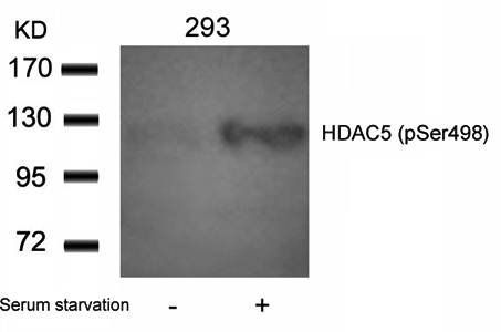 HDAC5 (Phospho-Ser498) Antibody