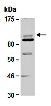 HDAC7 antibody