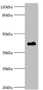 HDAC8 Antibody