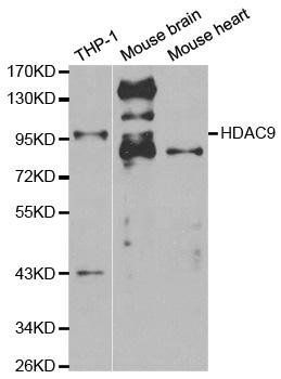 HDAC9 antibody