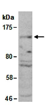 HDAC9 antibody