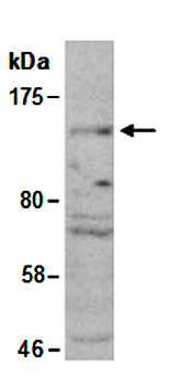 HDAC9 (C) Antibody, Rabbit Polyclonal